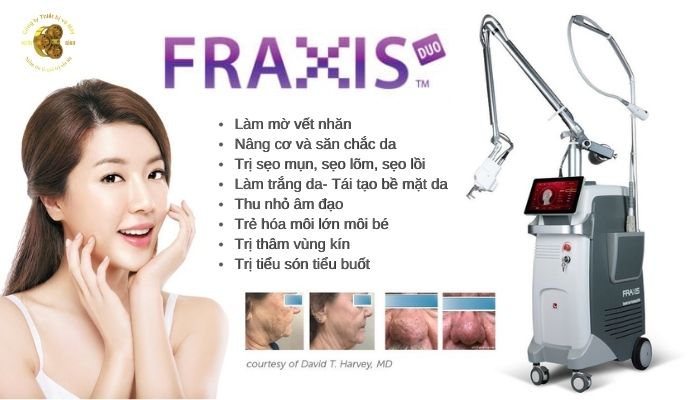 Hiệu quả điều trị bằngg máy fraxis duo