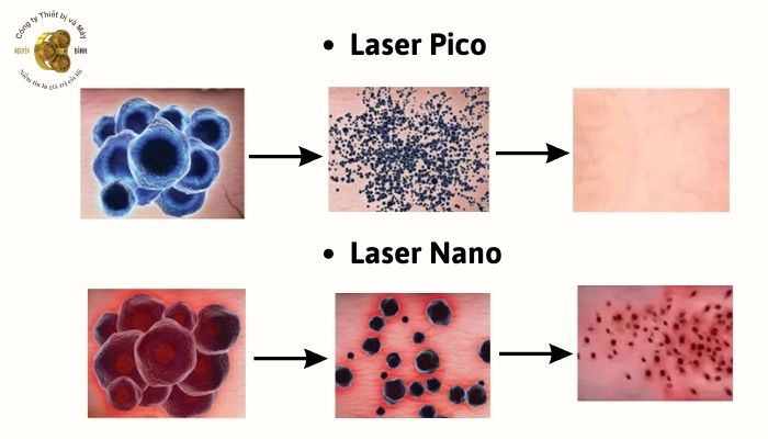 So sánh sự khác nhau giữa Laser Pico và Laser Nano, Solis vo6