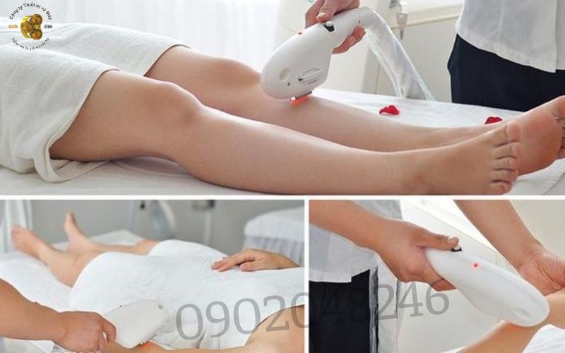 Lợi Ích Của Laser Triệt Lông