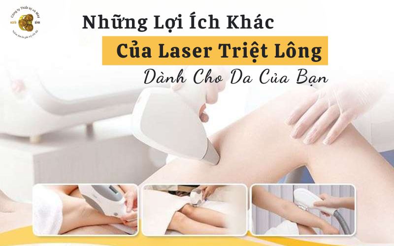 Lợi Ích Của Laser Triệt Lông