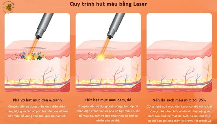 Lịch sử phát triển của công Nghệ Laser Nd YAG