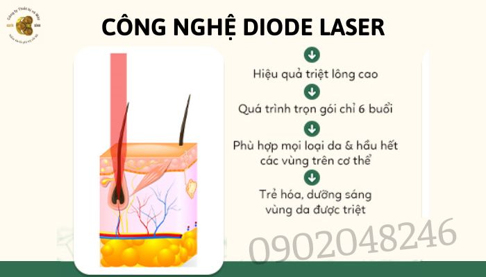 Máy triệt lông Diode Laser