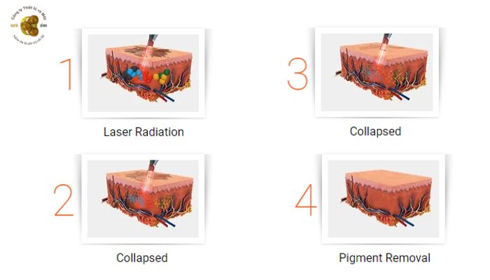 Giới thiệu về máy laser Solis VO3