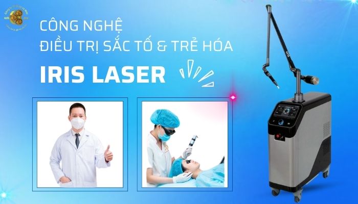 Công nghệ Laser Iris Bluecore trị nám