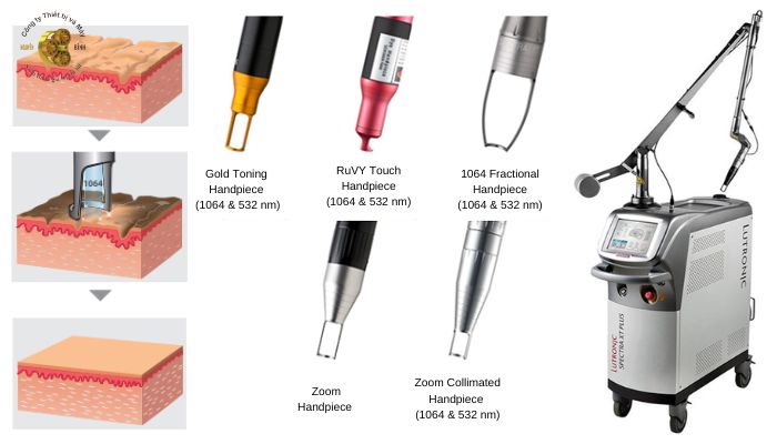 Máy Spectra XT Plus hoạt động như thế nào?