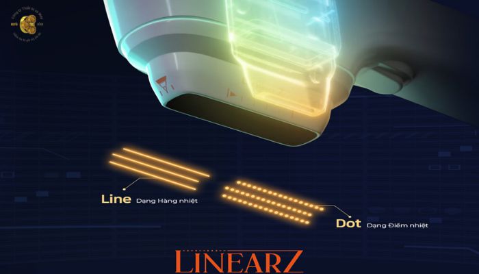 Linear Z – Công nghệ Hifu Linear đầu tiên trên thế giới 