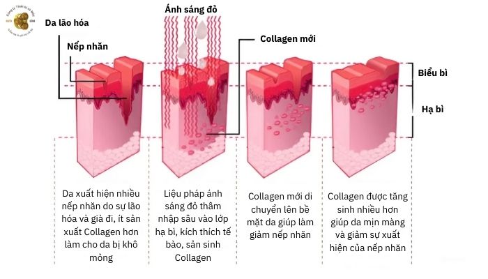 PDT trong đèn ánh sáng sinh học 7 màu