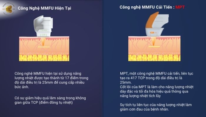 Ưu Điểm của Công Nghệ MPT