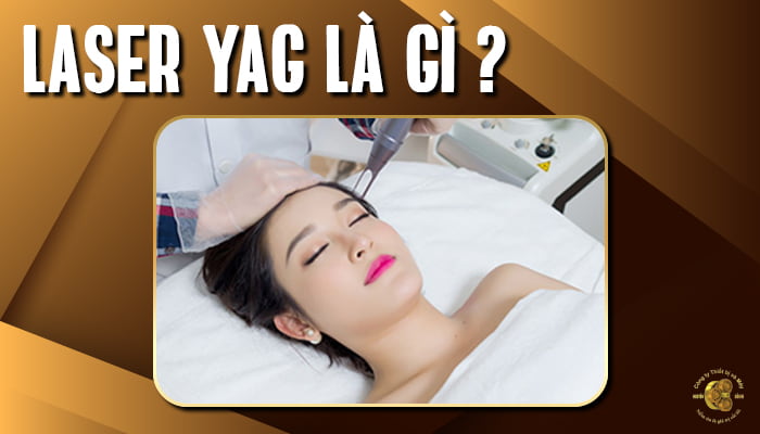 Công nghệ Laser YAG là gì?