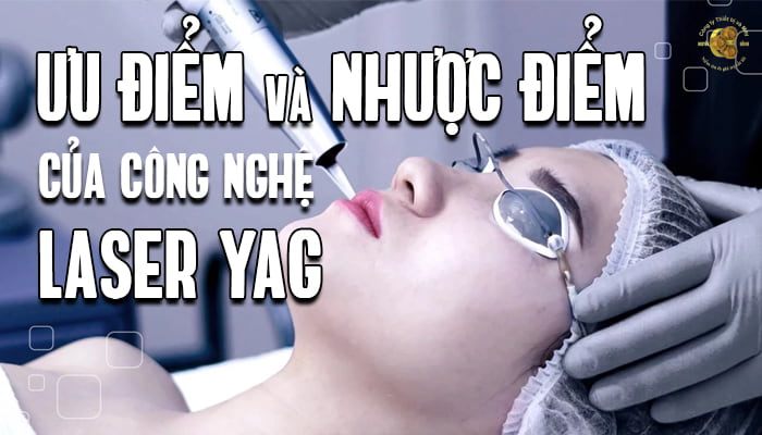 Ưu điểm và nhược điểm của laser YAG