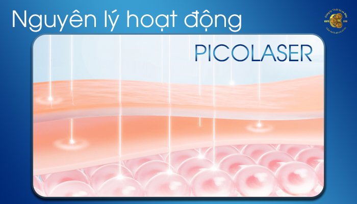 Pico Laser hoạt động như thế nào trên làn da của bạn