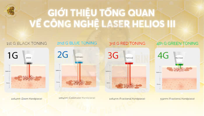 Giới thiệu tổng quan về công nghệ Laser Helios III