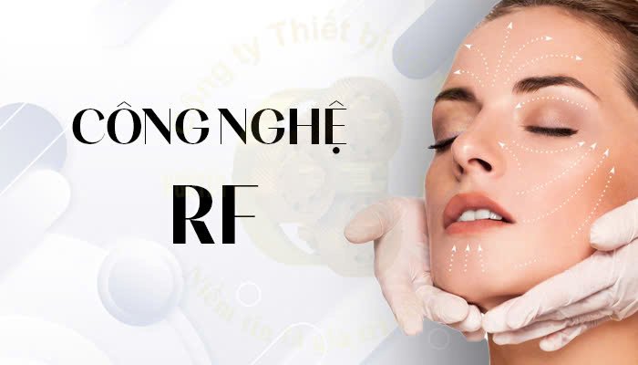  Công nghệ RF