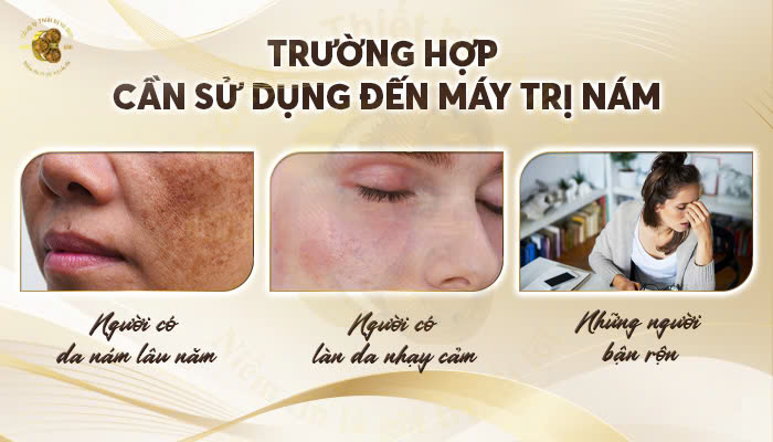 Trường hợp cần sử dụng đến máy trị nám