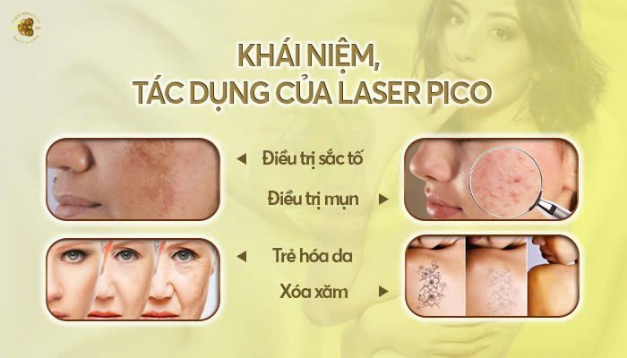 Khái niệm, tác dụng của Laser Pico