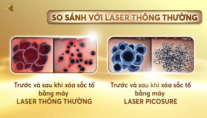 4. So sánh giữa máy laser Picosure với máy laser thông thường