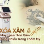 Máy xoá xăm, máy laser xoá xăm