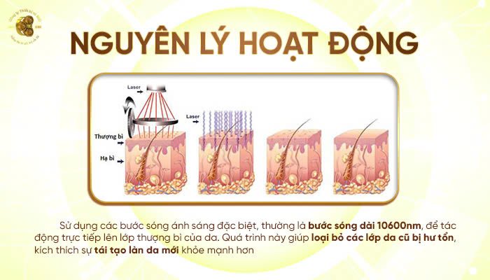 Nguyên lý hoạt động của máy trị sẹo