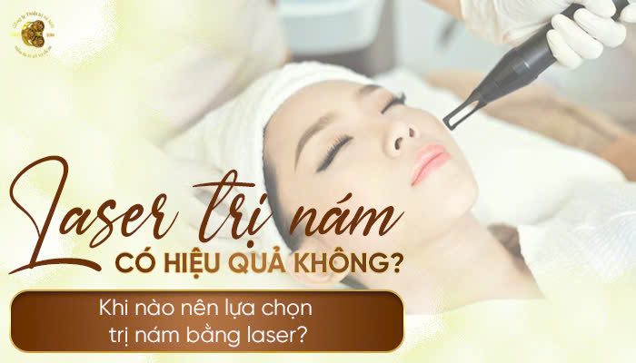 Bắn Laser Trị Nám Có Hiệu Quả Không? Khi Nào Nên Lựa Chọn Trị Nám Bằng Laser?