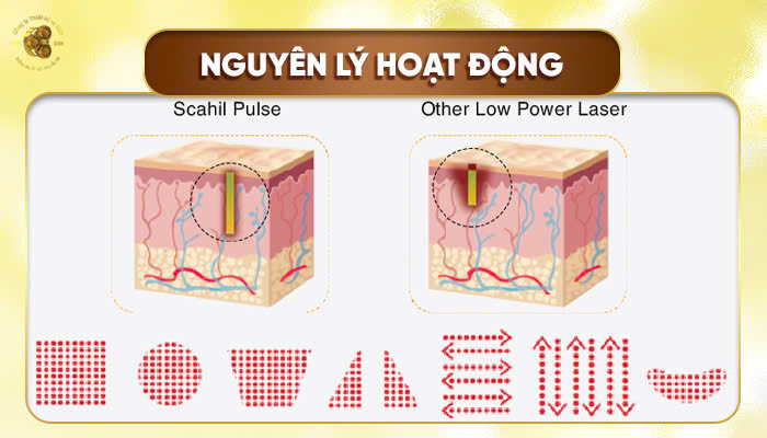 Nguyên lý hoạt động của máy Laser CO₂ Fractional Scahil