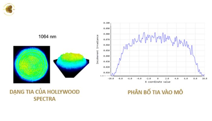 Nguyên lý hoạt động của máy Laser Hollywood Spectra