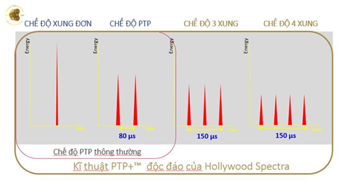 Kỹ thuật cải tiến PTP+ của Laser Hollywood spectra