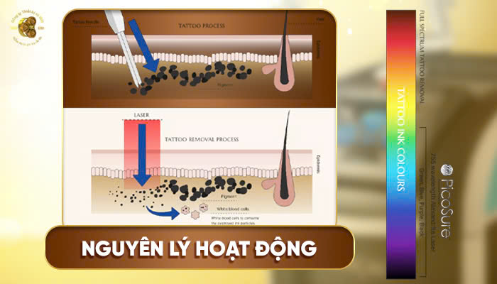 Nguyên lý hoạt động máy picosure cynosure