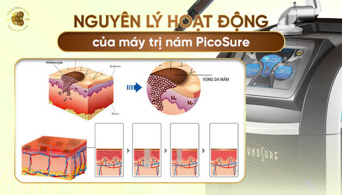 Nguyên lý hoạt động của máy trị nám PicoSure