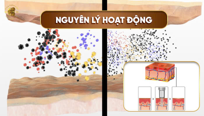 Cơ chế hoạt động của Picoplus lutronic