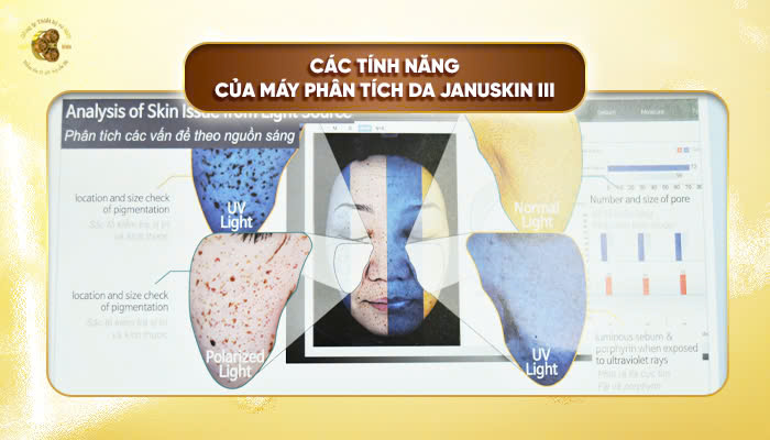 Các tính năng của máy phân tích da Januskin III