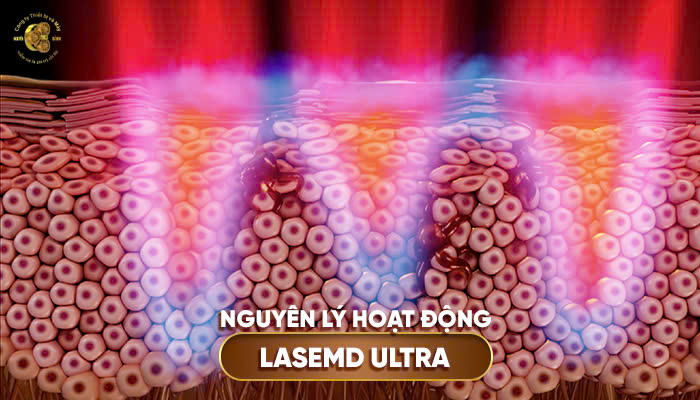 Công nghệ tiên tiến tích hợp trong Lutronic LaseMD Ultra Hàn Quốc