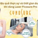 Hiệu quả Laser Picosure Pro duy trì trong bao lâu?