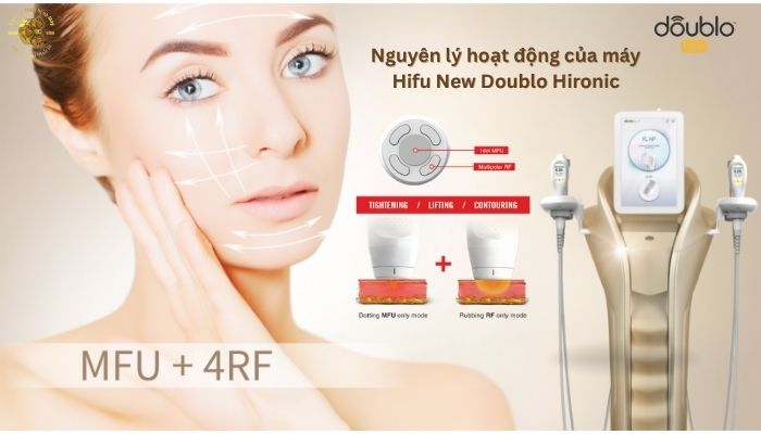 Nguyên lý hoạt động của máy Hifu New Doublo Hironic