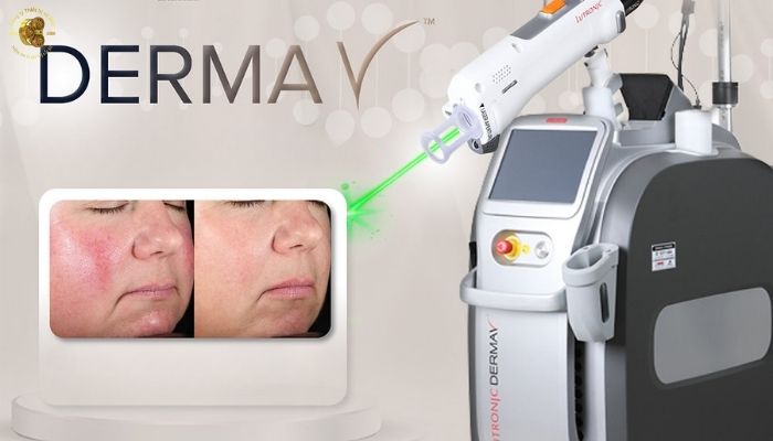 Ứng dụng điều trị của máy Laser Derma V