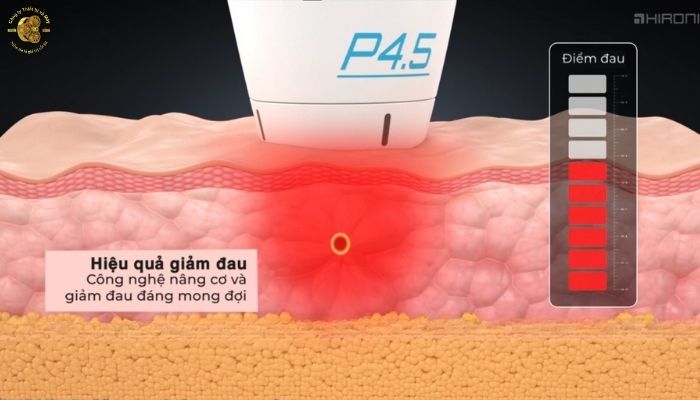 Thiết kế, trải nghiệm và hiệu quả điều trị