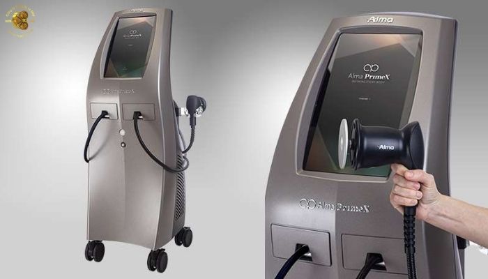 Giới thiệu tổng quan về máy giảm béo Alma PrimeX