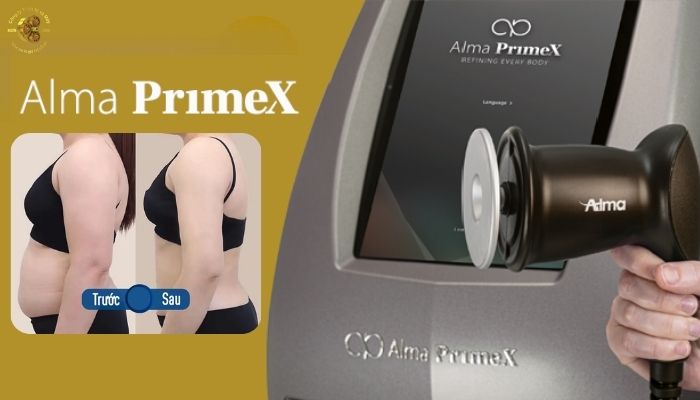 Công nghệ sóng vô tuyến RF