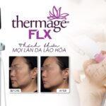 Nâng Cơ Trẻ Hóa Da Bằng Sóng RF, Bí Quyết Giữ Mãi Thanh Xuân Cho Làn Da Phụ Nữ Hiện Đại