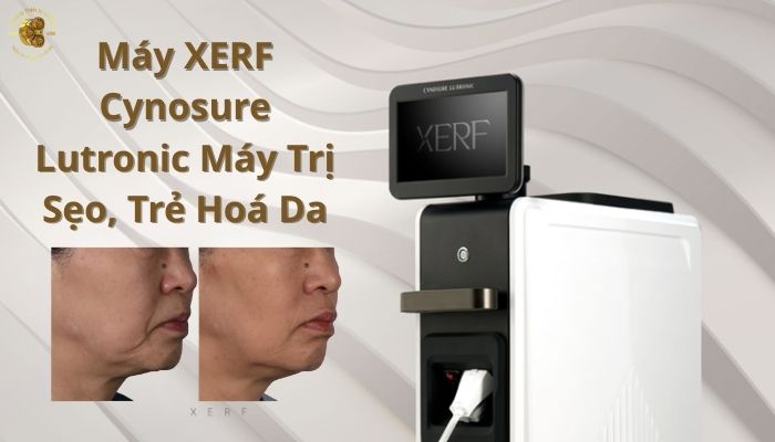 XERF là gì? Công nghệ RF đơn cực kép đột phá