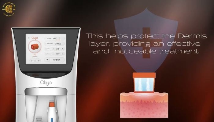 Giới thiệu chung về máy nâng cơ RF Oligio X