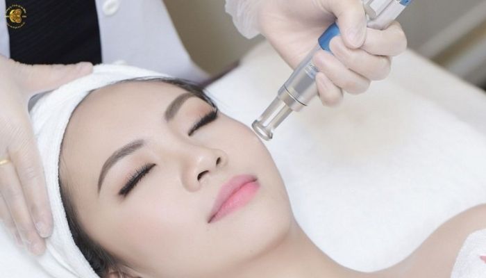 Các công nghệ máy trị nám công nghệ cao phổ biến hiện nay