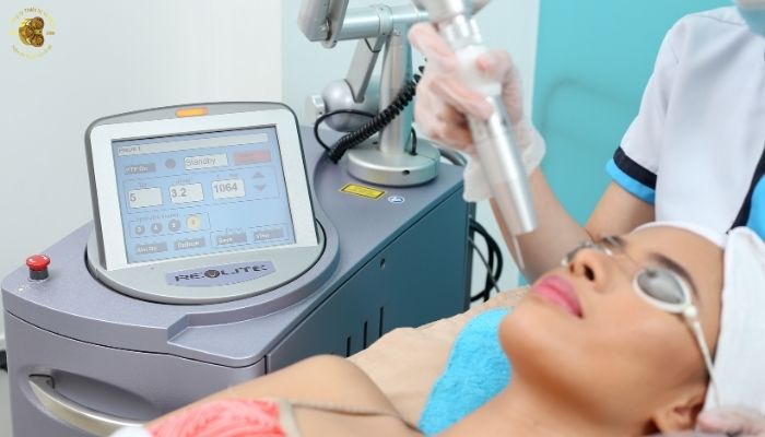 Nguyên lý hoạt động của laser Nd:YAG Revlite SI