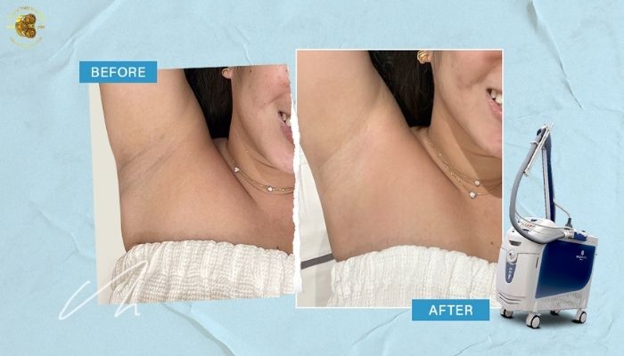 Ứng dụng lâm sàng đa dạng của SPLENDOR X