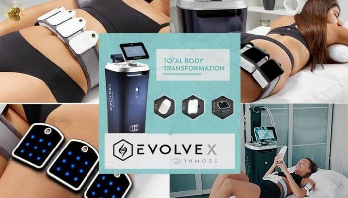 Vì sao EvolveX InMode được đánh giá cao trong công nghệ tạo hình cơ thể?