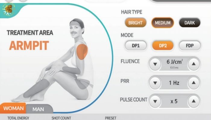 Máy triệt lông Diode Vikini Illoda đa di năng