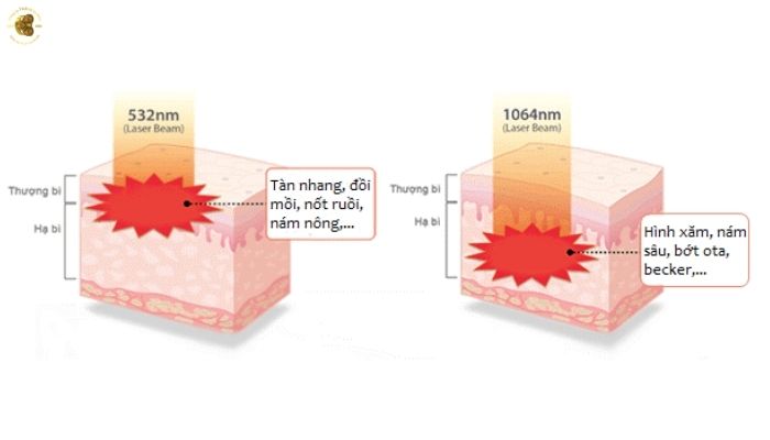 Nguyên lý hoạt động của laser Q-Switched