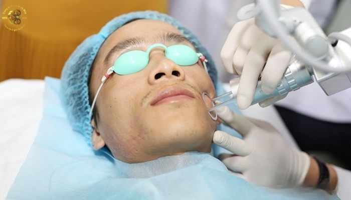 Những loại sẹo nào phù hợp với Laser CO2 trị sẹo?