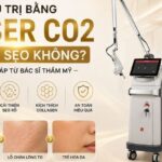 Điều trị bằng laser CO2 có bị sẹo không? Giải đáp từ bác sĩ thẩm mỹ