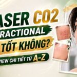 Những lưu ý quan trọng trước và sau khi điều trị Laser CO2 Fractional