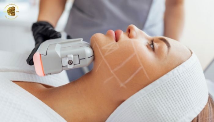 Ưu điểm của máy HIFU trong nâng cơ trẻ hóa da